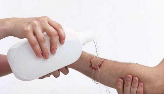  Cum se curata taieturile