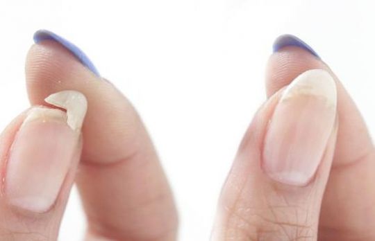 Cum sa-ti salvezi unghiile rupte 