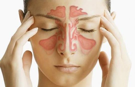 Cum sa scapi de sinuzita. 3 metode 100% naturale