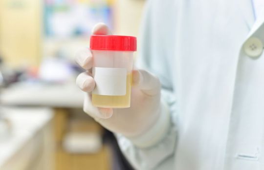 Cum se face sumarul de urina