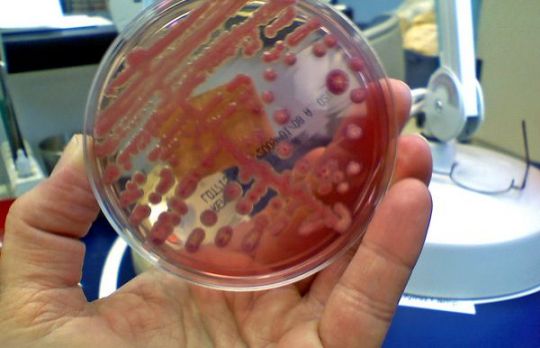 Ce este si cum se face urocultura