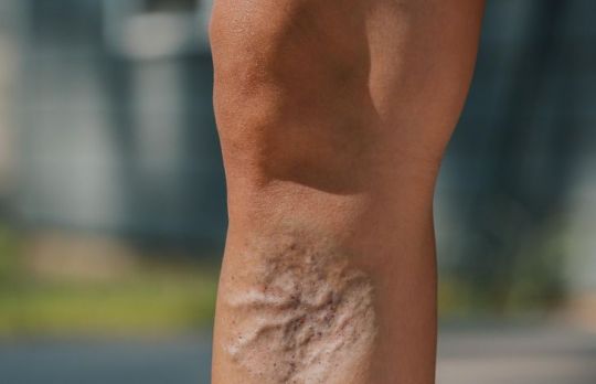 Trasaturi rare ale corpului uman. Te reprezinta vreuna?