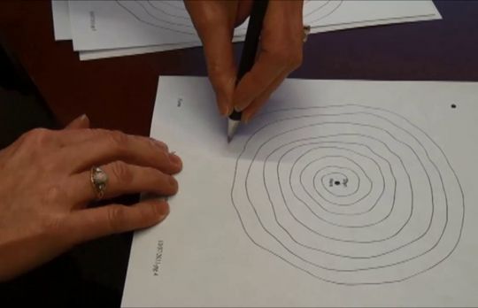 Cum sa tratezi tremorul esential. Metode naturiste