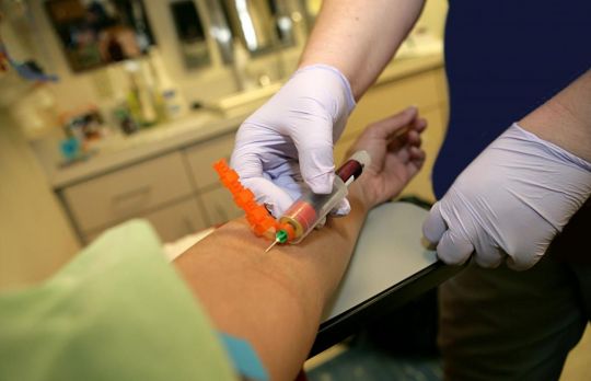 Cum sa scazi nivelurile de amilaza